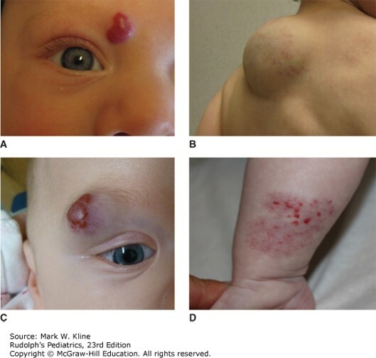 Skin Disorders Case