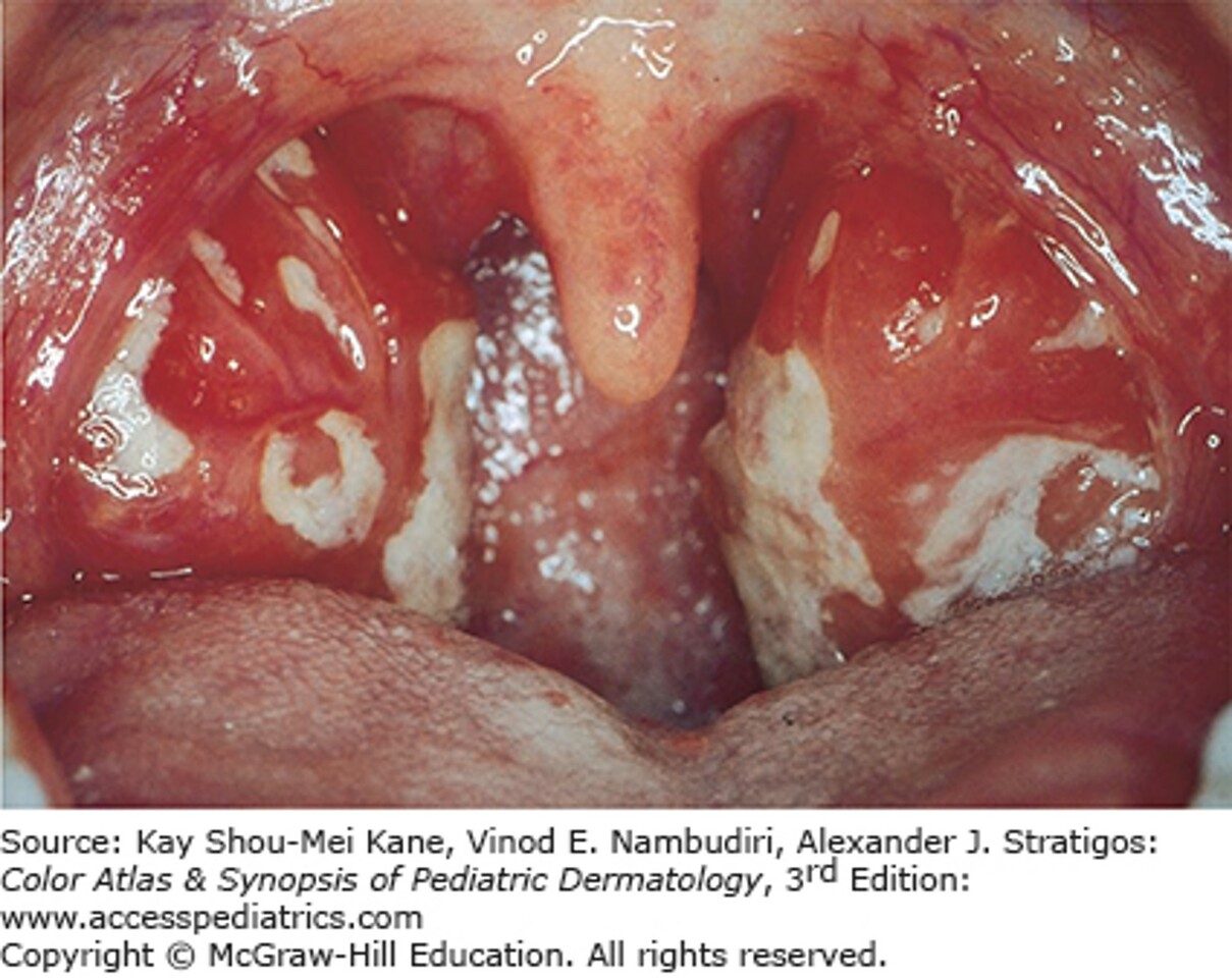 Infectious Disease Case 