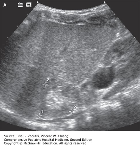 Renal and Urologic Disorders Case