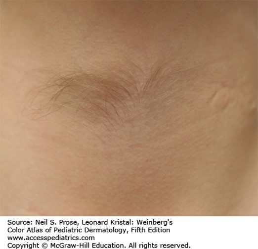 Miscellaneous Anomalies Diagnosis 