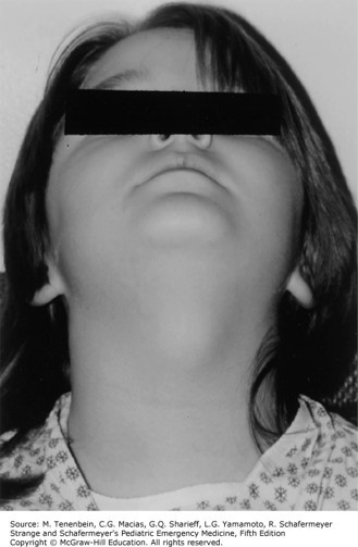 Ear, Nose and Throat Disorders Case