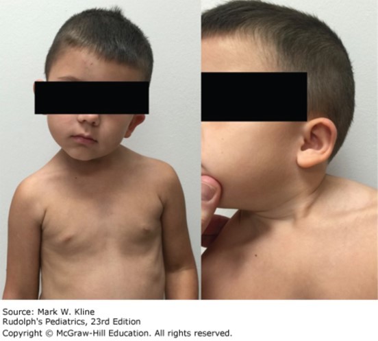 Musculoskeletal Disorder Case 