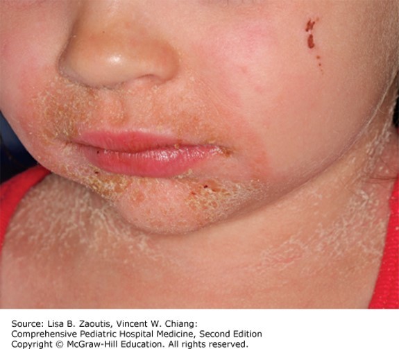 Skin Disorders Case