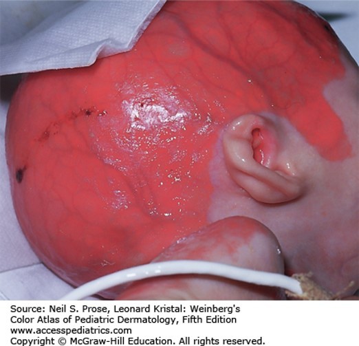 Genodermatoses Diagnosis