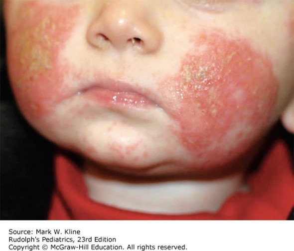 Skin Disorders Case 