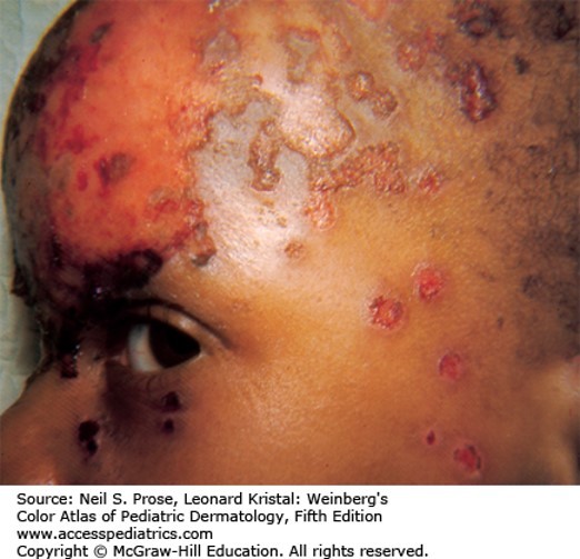 Viral Diseases Diagnosis 