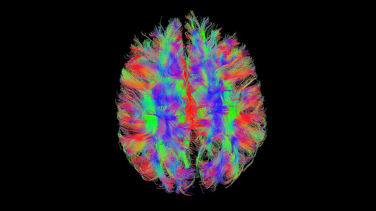 Book Review: The Remarkable Adaptability of the Human Brain