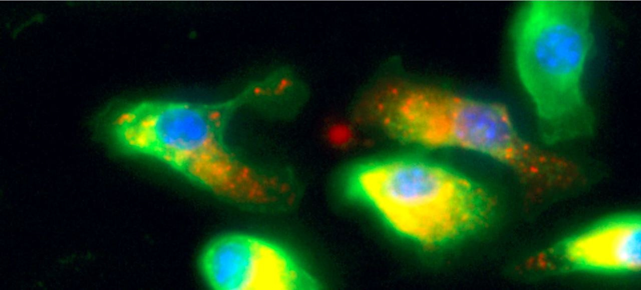 Re-educating tumor macrophages for immunotherapy