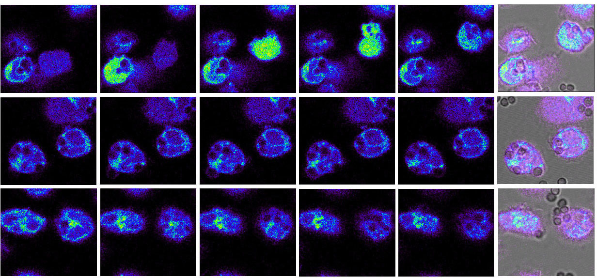 Calcium binding by fungal melanin has essential immunological function