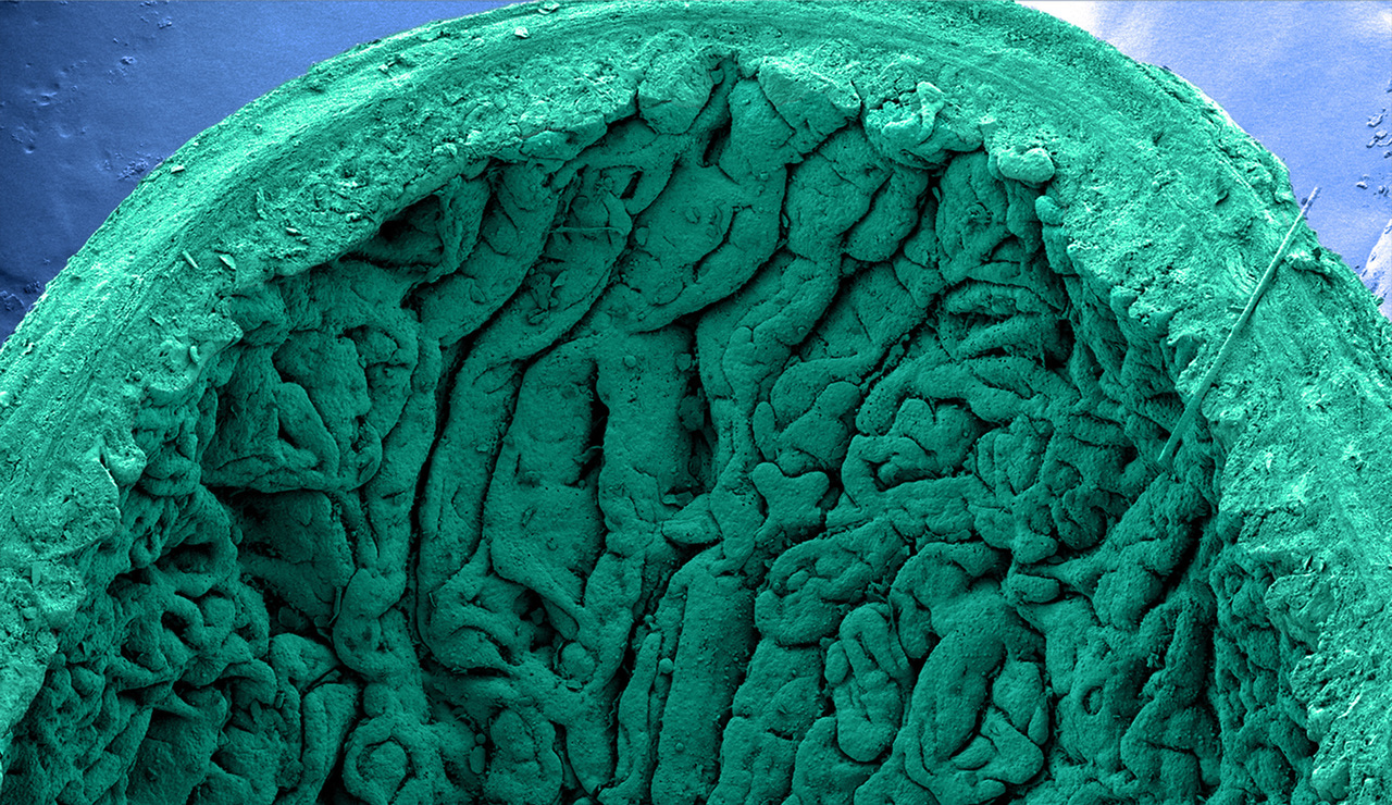 Springing human intestinal organoids forward