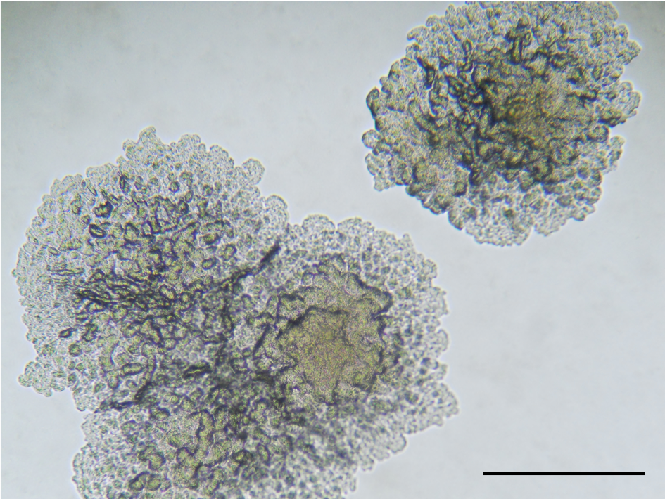 Discovery of a new Mycobacterium tuberculosis lineage and the transcontinent collaboration behind it
