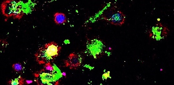 Bi-functional supramolecule for macrophage immunotherapy