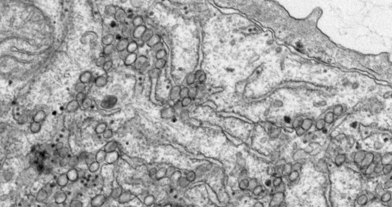 A small ISG with big consequences for flavivirus replication 