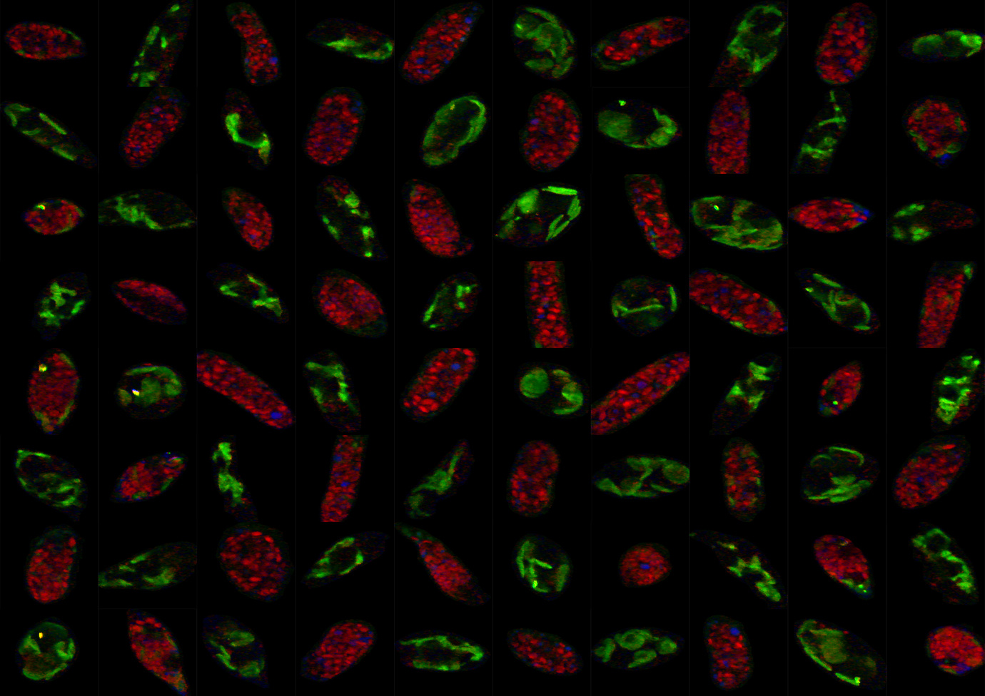 Interdisciplinary engineering efforts elucidate the metabolic heterogeneity of microalgae
