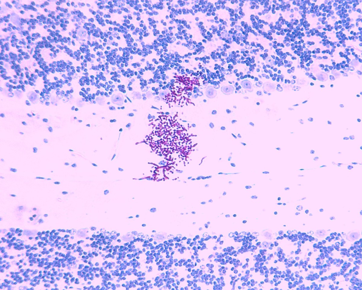 What makes Candida auris a super fungus?