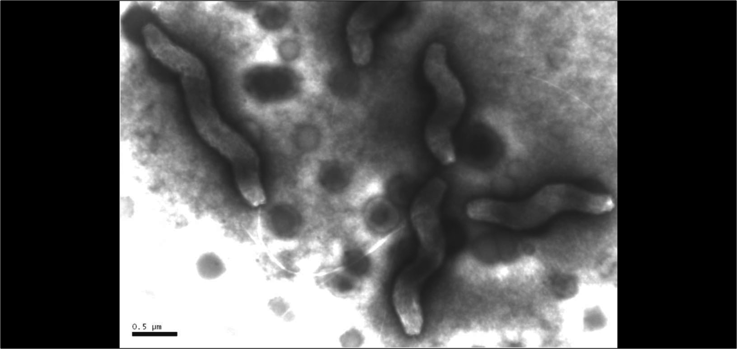 INNUENDO – “one size fits all” approach for bacterial WGS integration in routine surveillance and epidemiological investigation