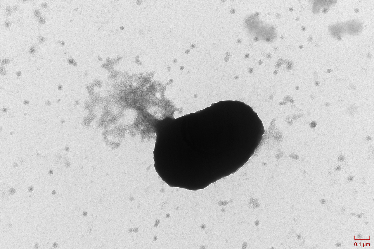 Illuminating virus-host dynamics in deep terrestrial ecosystems