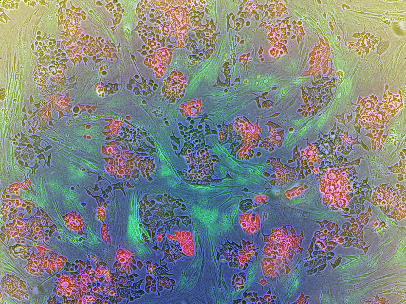 The evolutionary games played by cancer