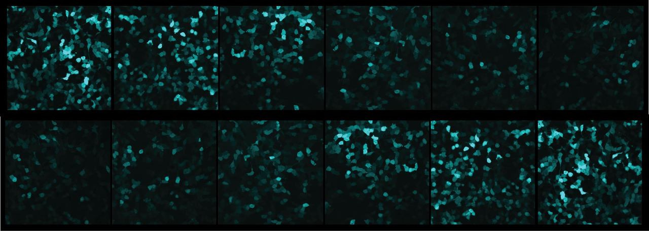 Gene expression gets a tune up