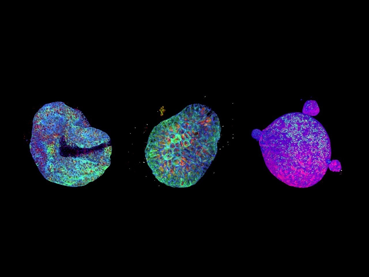 Human Kidney Tubuloids
