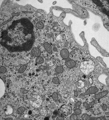 Energizing our immune cells: using different routes for the best response