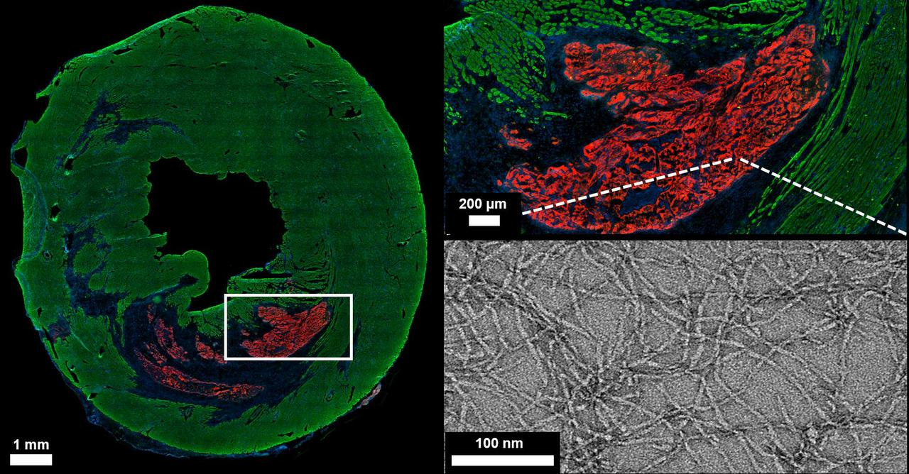 Inflammation Triggerable Peptide Hydrogel Materials for Targeting Damaged Heart Tissue following Myocardial Infarction