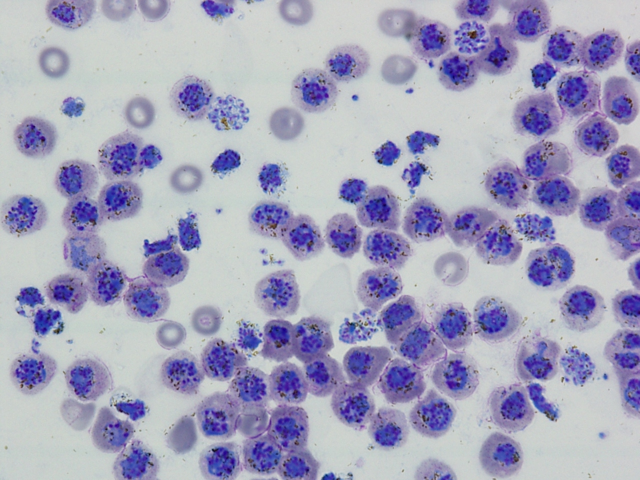 Understanding human vaccine-induced immunity in vivax malaria