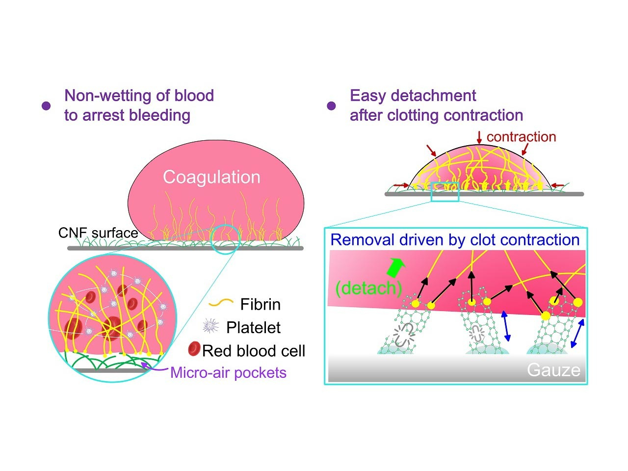 Superhydrophobic Biomaterial Makes an Ideal Gauze: Rapid Bleeding Stoppage and Easy Removal After Healing Prevents Infections 