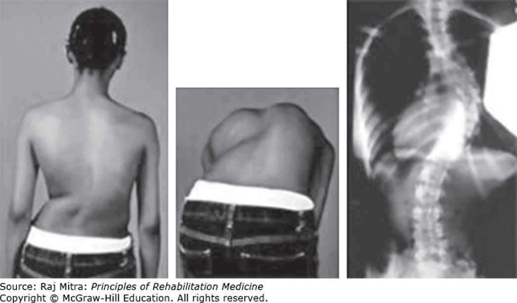 Musculoskeletal Disorders Diagnosis