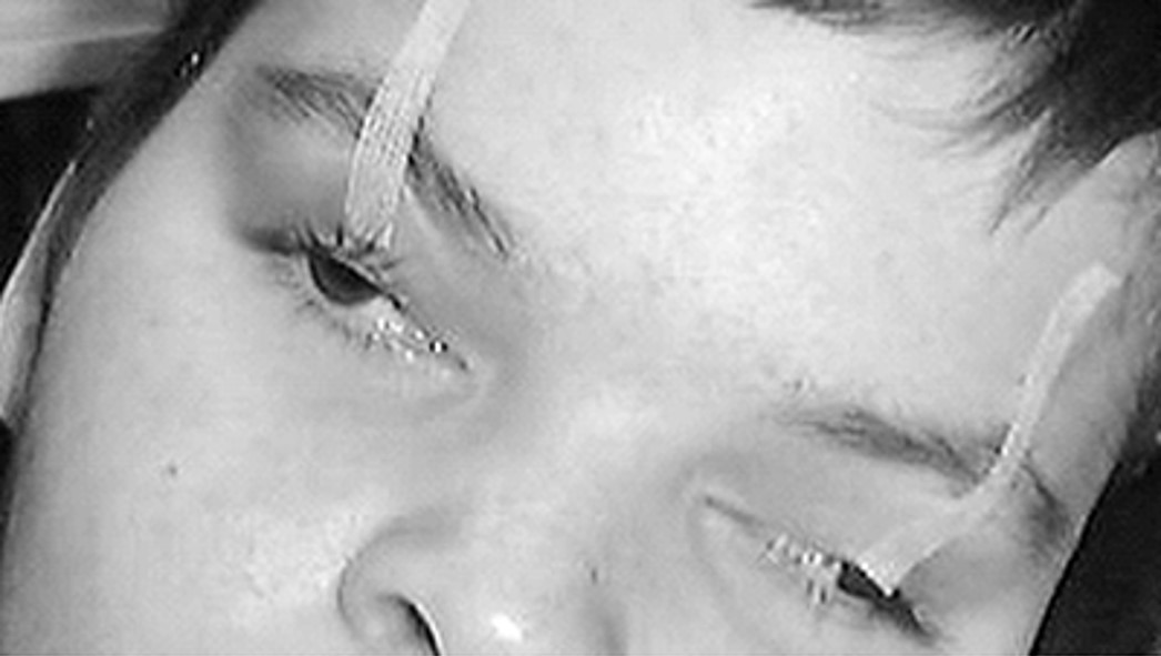 Pediatric Cranial Nerve Disorders Diagnosis