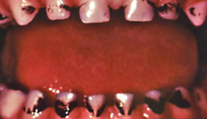 Oral Cavity Disorders Case