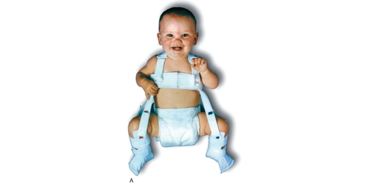 Musculoskeletal Disorder Diagnosis