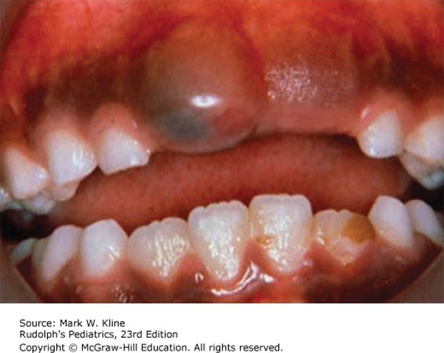 Oral Pathology Diagnosis