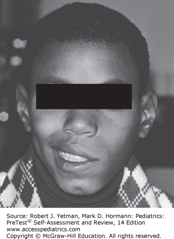 General Pediatrics Case