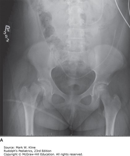 General Pediatrics Case