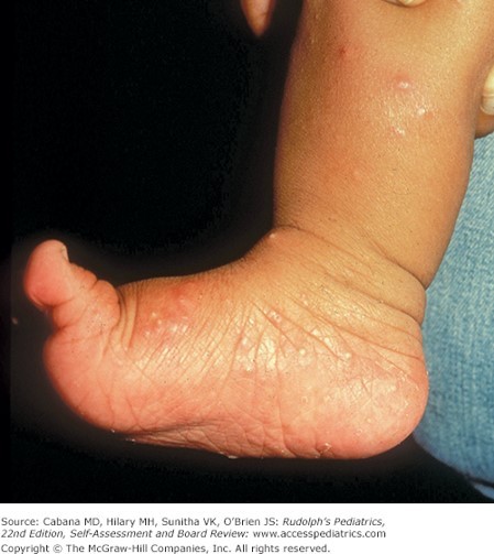 Skin Disorders Case