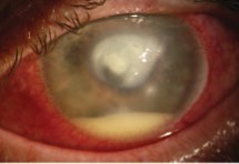 Facial Nerve Disorder Diagnosis