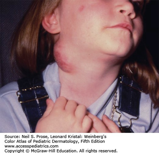 Infectious Diseases Case