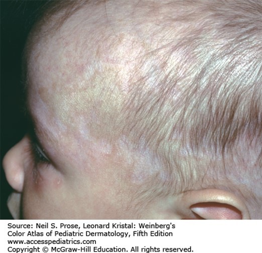 Systemic Diseases Diagnosis