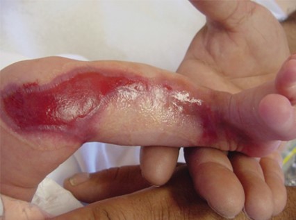 Dermatology Case