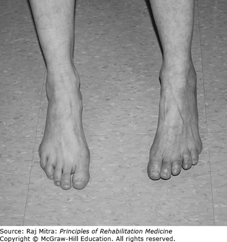 Pain Syndrome Diagnosis