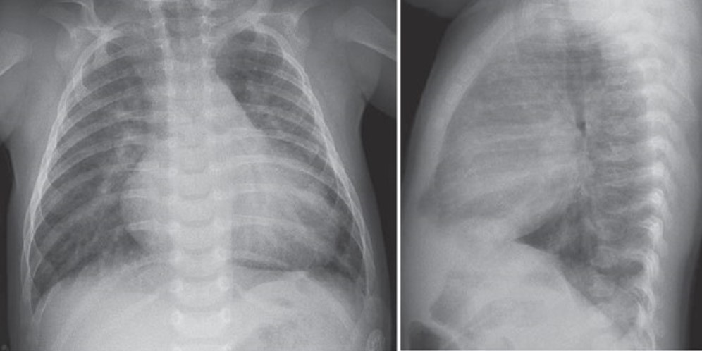 Cardiovascular Disorders Case