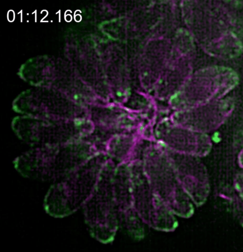 Tangled up in actin: how the actin network in  Toxoplasma gondii facilitates vesicular trafficking during replication