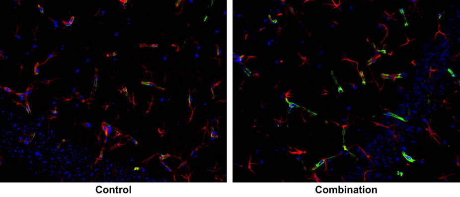 Editorial Summary:  Neuroscience: Space travel on the brain