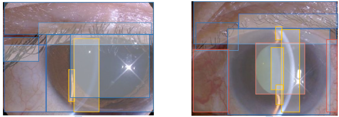 Dense anatomical annotation of slit-lamp images improves the performance of deep learning for the diagnosis of ophthalmic disorders