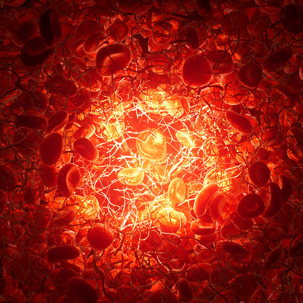 Intraoperative real-time blood monitoring