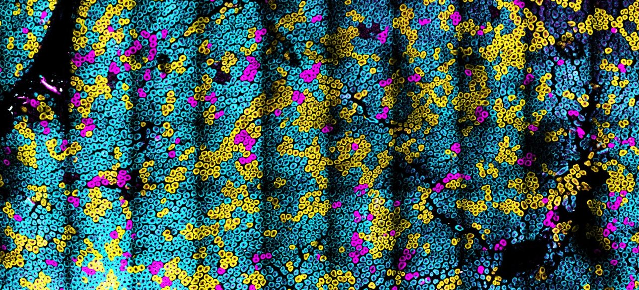 A cancer rainbow mouse for visualizing the functional genomics of oncogenic clonal expansion