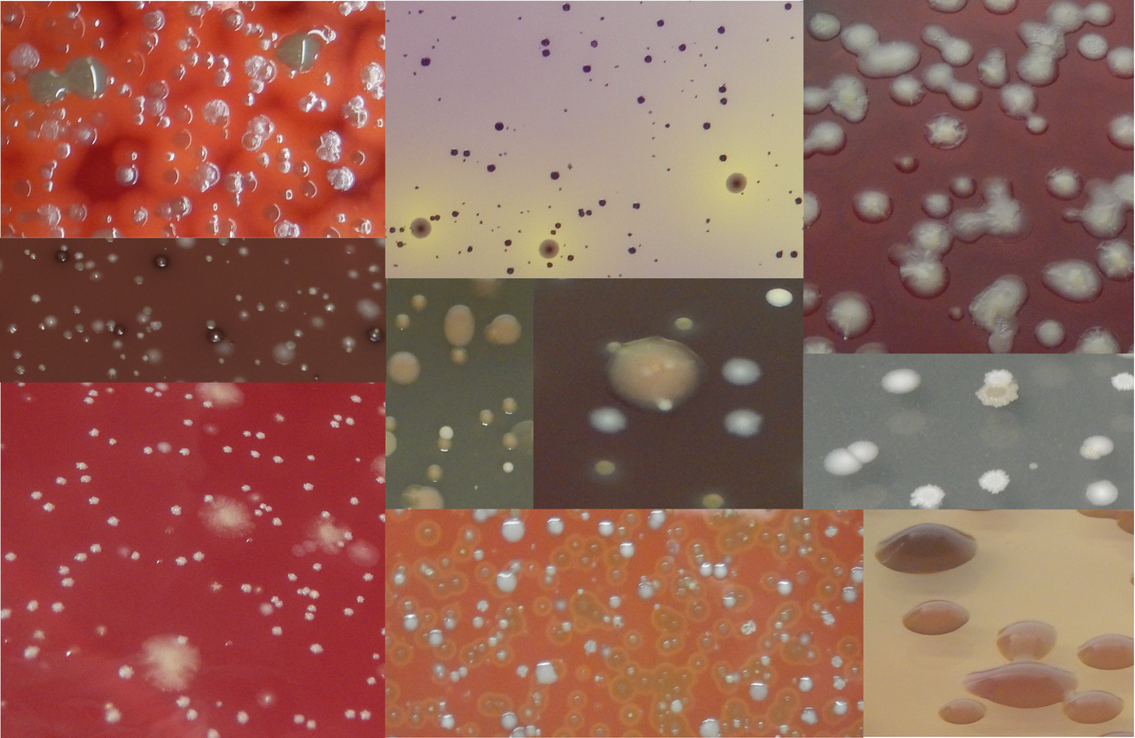 The old with the new: the importance of combining microbial culture with DNA sequencing for the future of microbiome research.