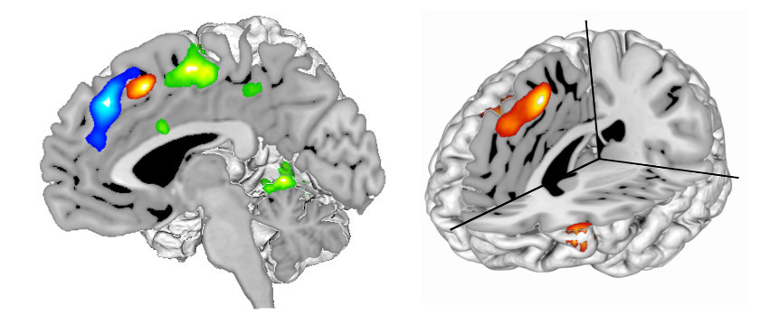 The surprising role of anterior cingulate in motivated control