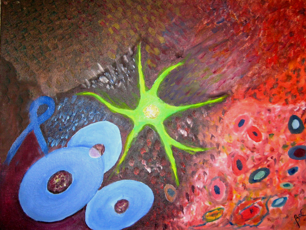 Elevated levels of SPINK1 governs cellular plasticity and maintains neuroendocrine phenotype in prostate cancer. 